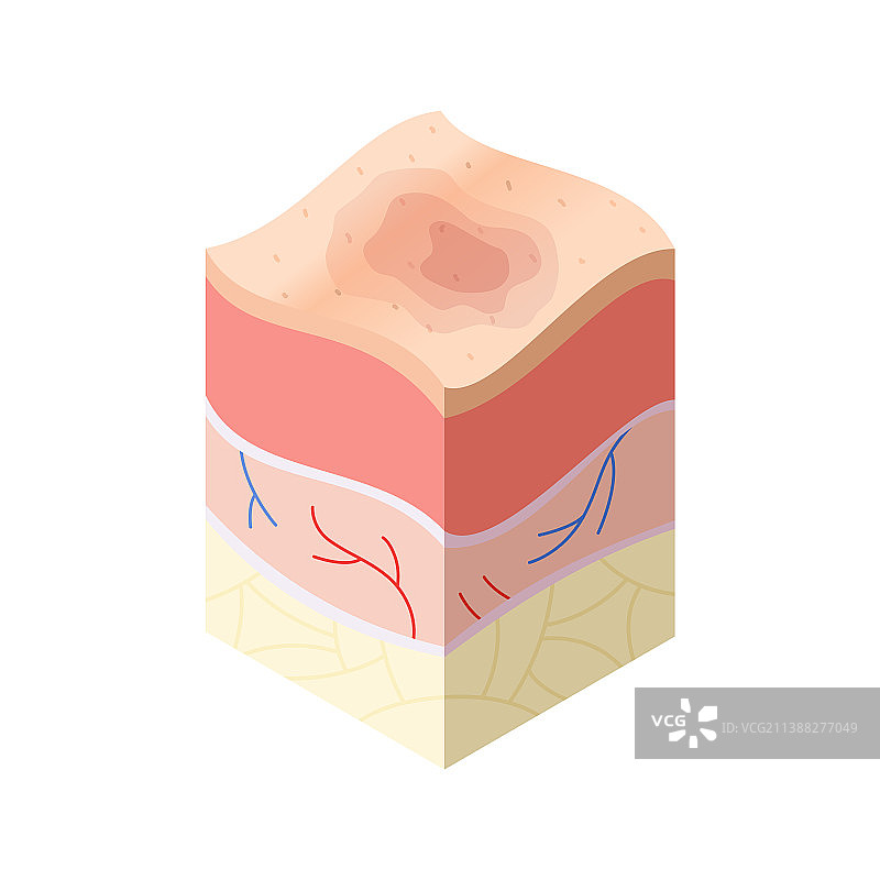 交叉的皮肤护理医学概念问题图片素材
