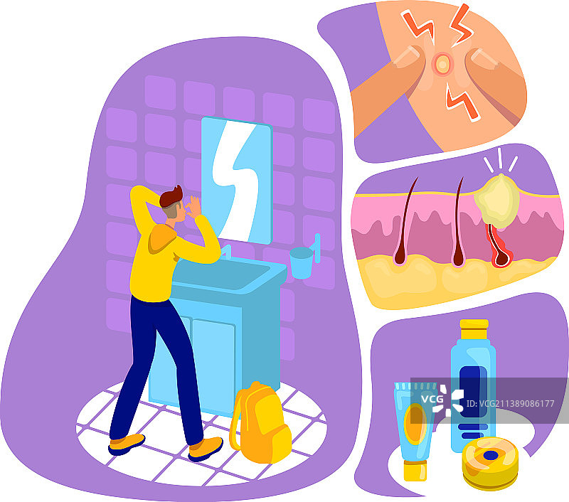 扁平风格粉刺概念图片素材