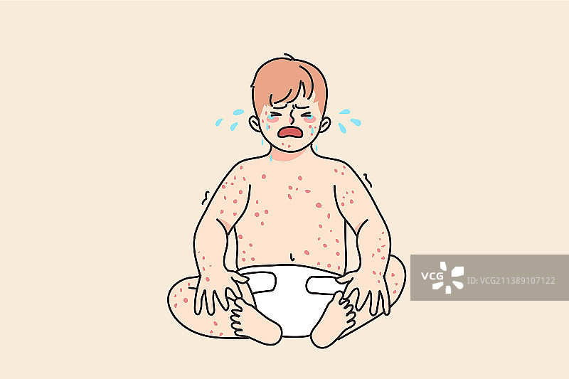 患有湿疹而哭闹的婴儿图片素材