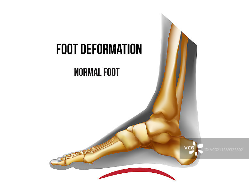 足部骨骼正常足弓结构图片素材