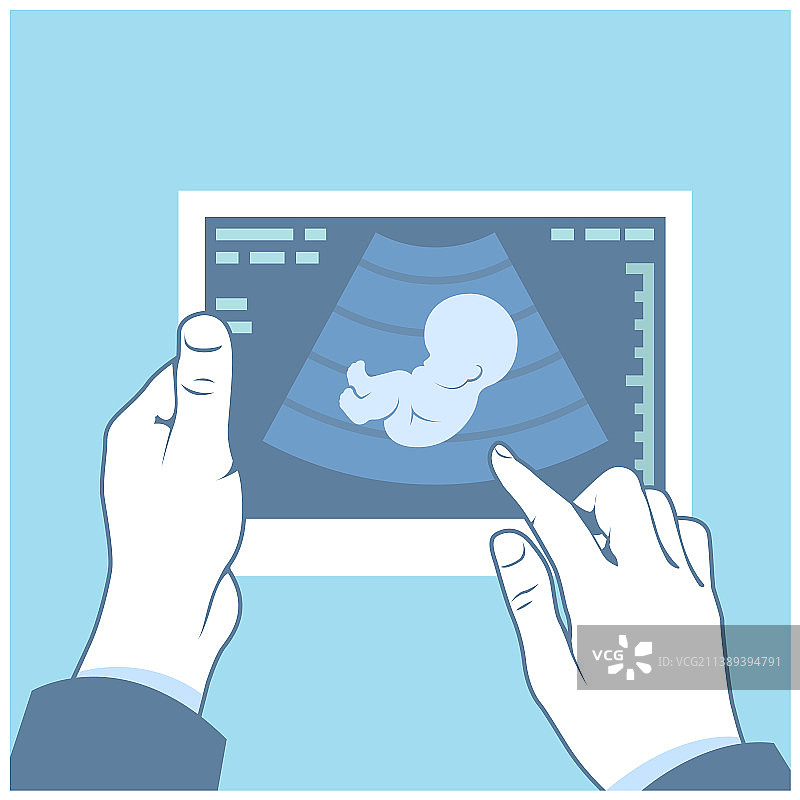 胎儿的超声扫描图图片素材