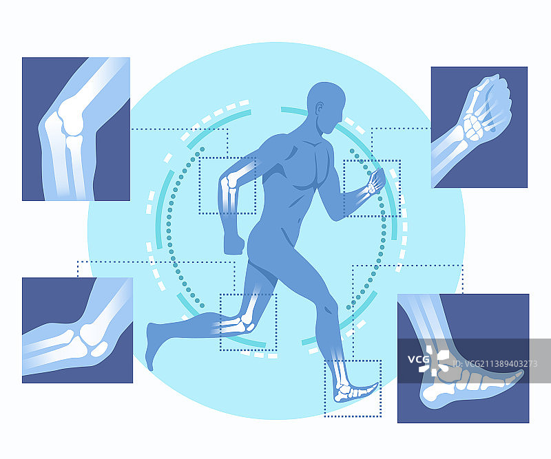 骨科技术概念图片素材