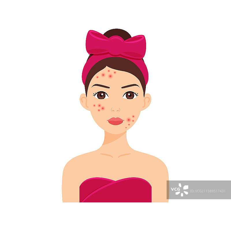 面部有痤疮的年轻漂亮女人图片素材