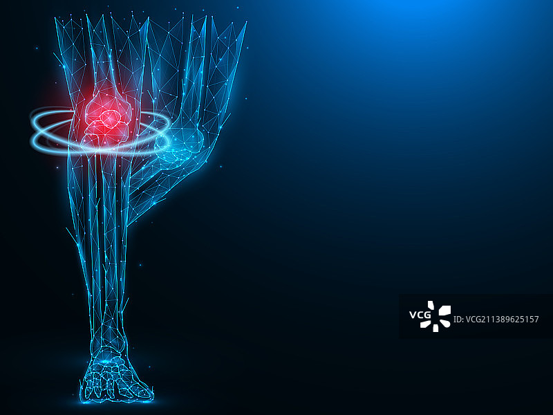 人类腿部多边形疼痛和发炎的膝盖图片素材