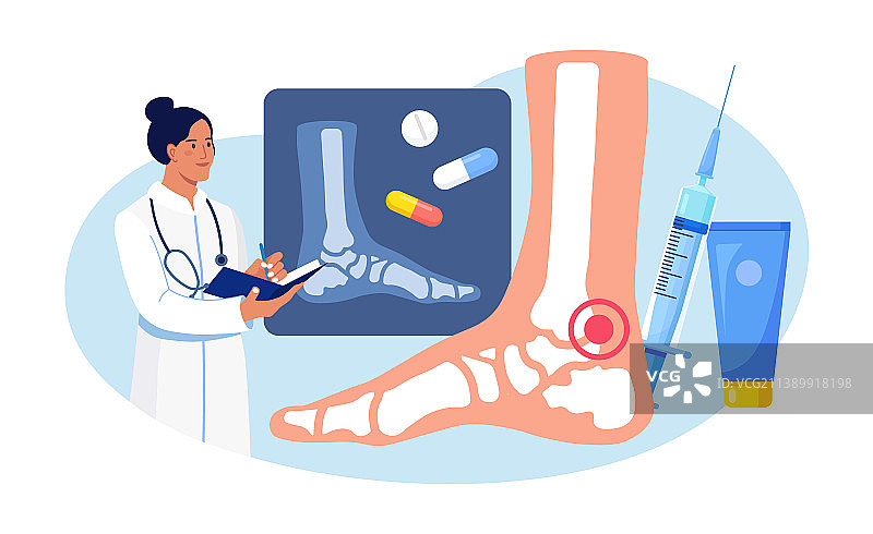 医生检查脚踝关节炎X光片图片素材