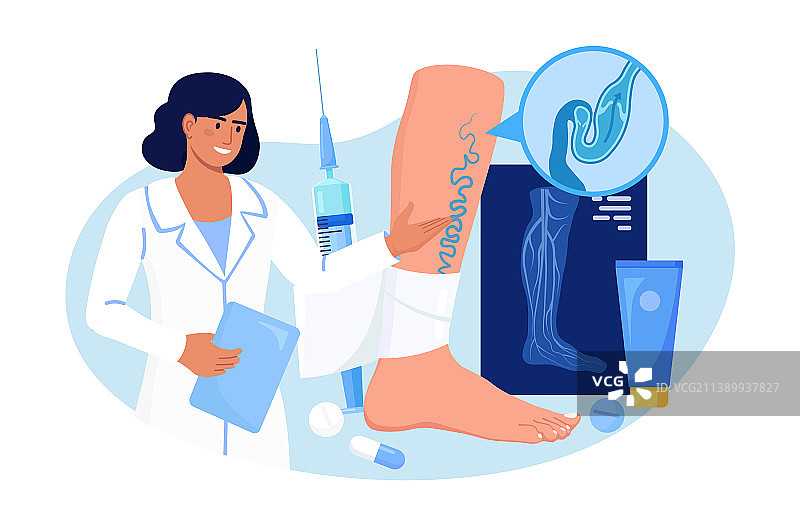 静脉血栓和静脉曲张治疗外科医生图片素材