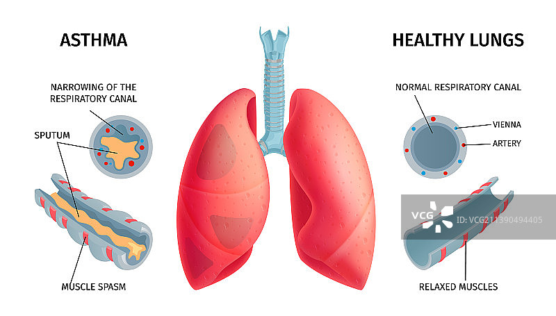 人体肺部解剖信息图图片素材