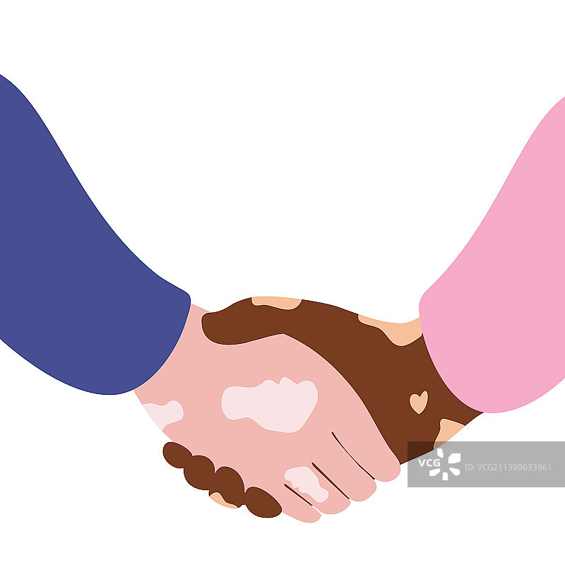 白癜风患者友好的握手图片素材