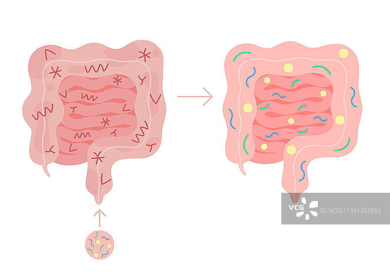 健康人群的肠道菌群移植图片素材