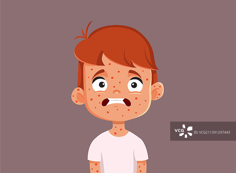 患麻疹的儿童卡通形象图片素材