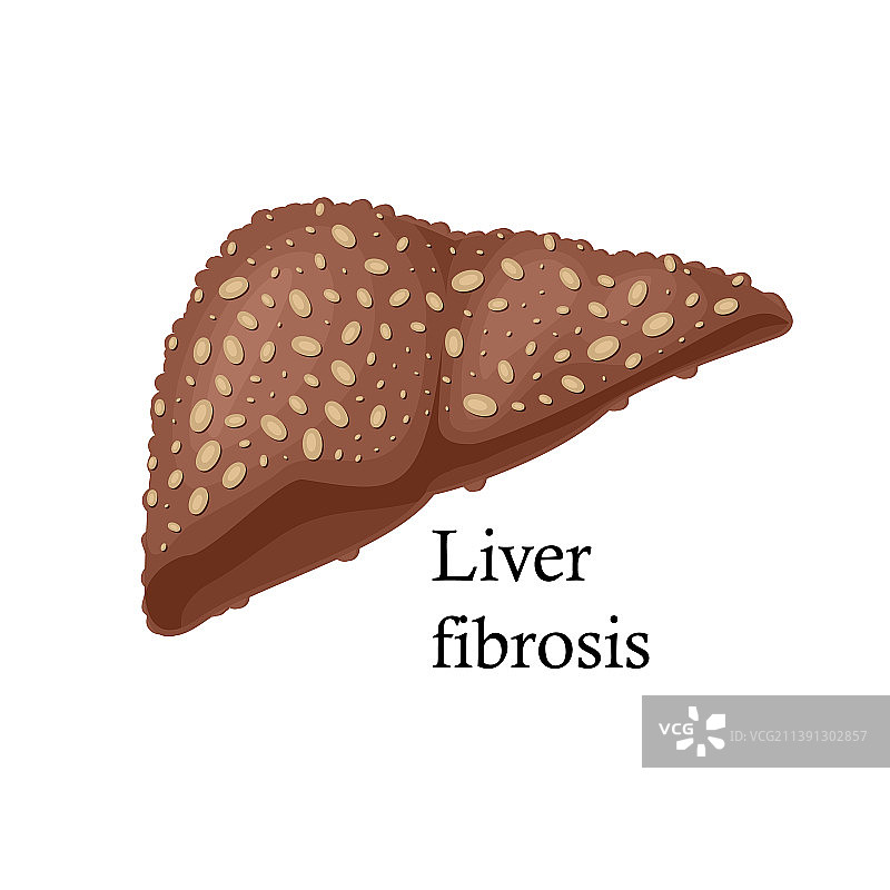 白色背景上的肝纤维化图片素材