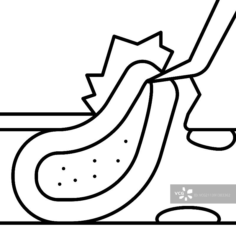 颈动脉内膜剥脱术线条图标图片素材