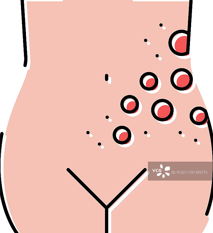 带状疱疹疾病彩色图标图片素材