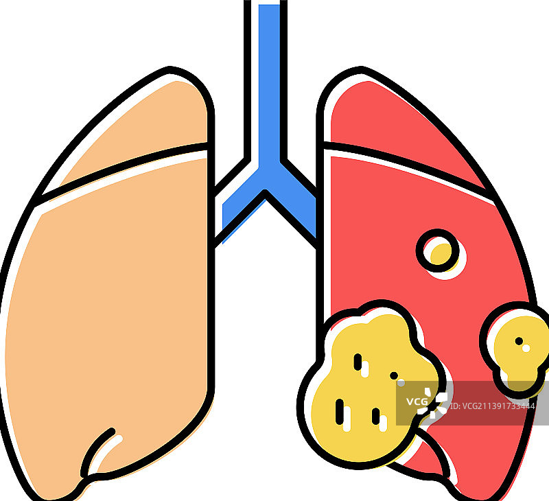 急性呼吸窘迫综合征彩色图标图片素材