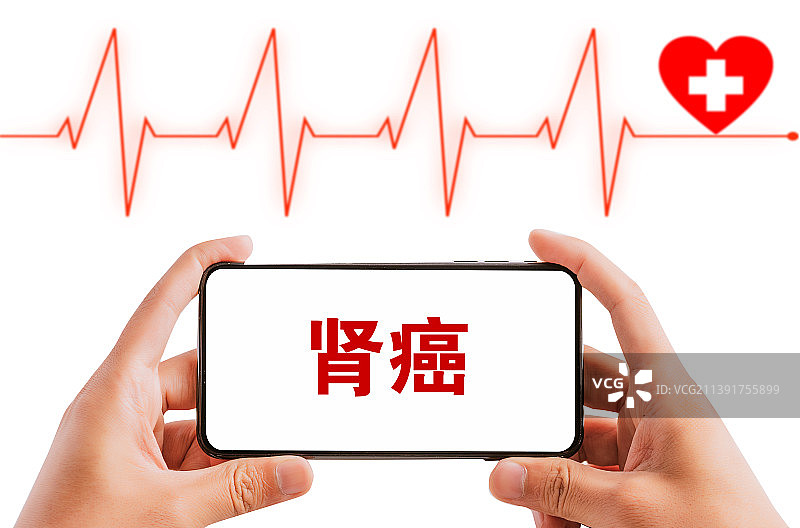 医疗概念配图：肾癌图片素材