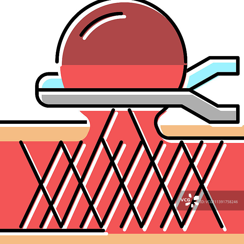 动脉瘤修复彩色图标图片素材