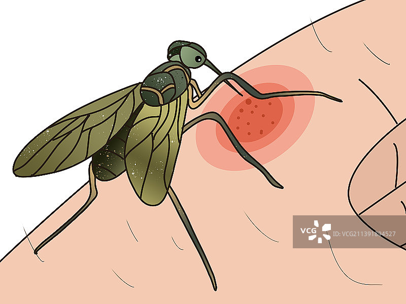手上有蚊子身体部位被蚊虫叮咬注意防范害虫插画图片素材