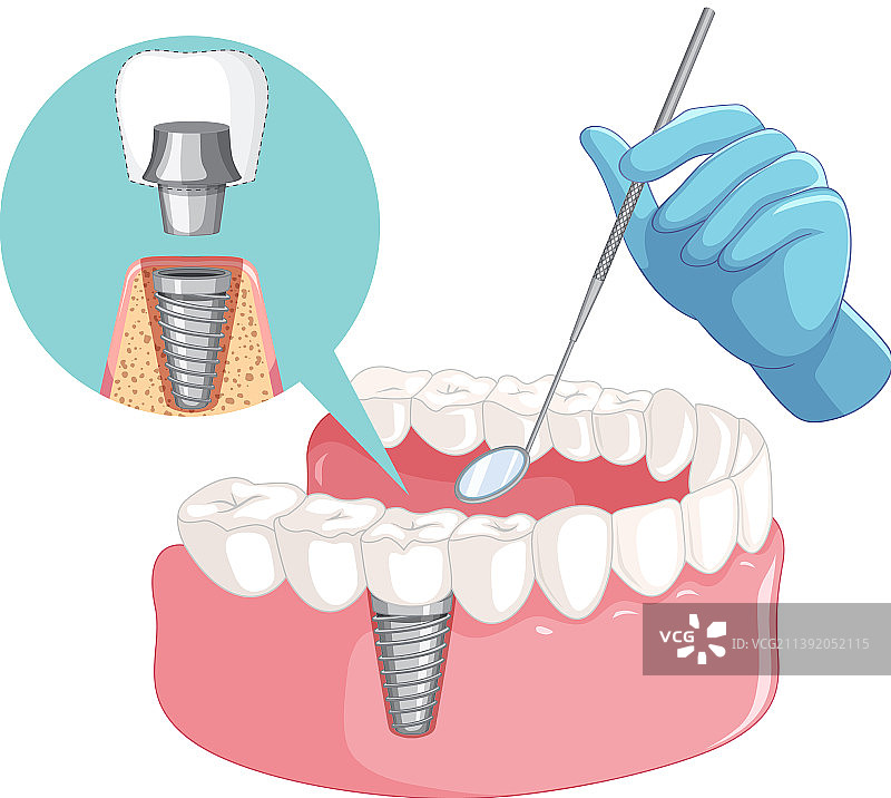 牙医手持人类牙齿模型图片素材