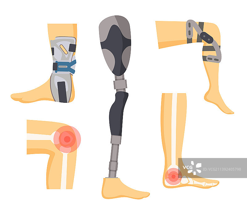 关节疼痛和腿部骨科护具图片素材
