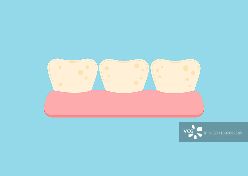 美白前的可爱牙齿与黄色牙菌斑图片素材