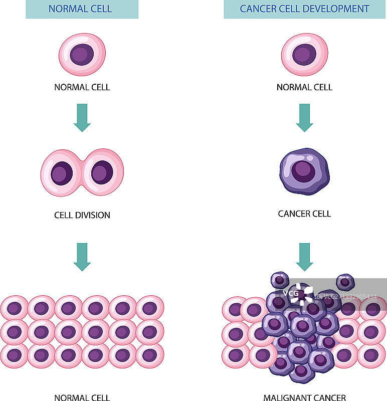 癌细胞发展过程图片素材