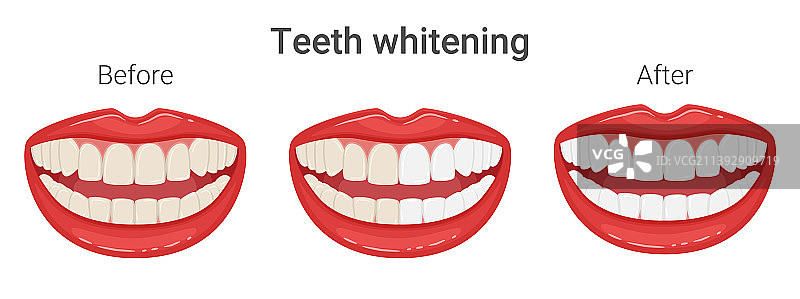 口腔中洁白的牙齿图片素材