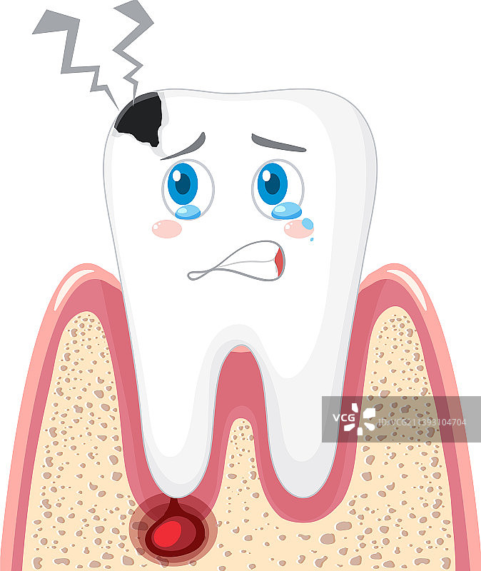 白色背景上的龋齿和牙龈炎症图片素材
