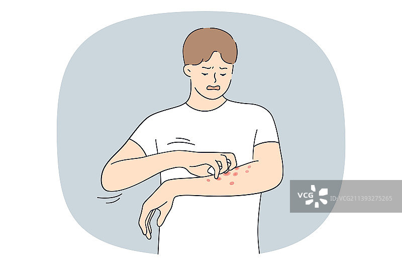 因过敏或牛皮癣而痛苦的男子图片素材