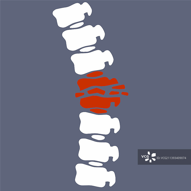 脊柱姿势问题图片素材