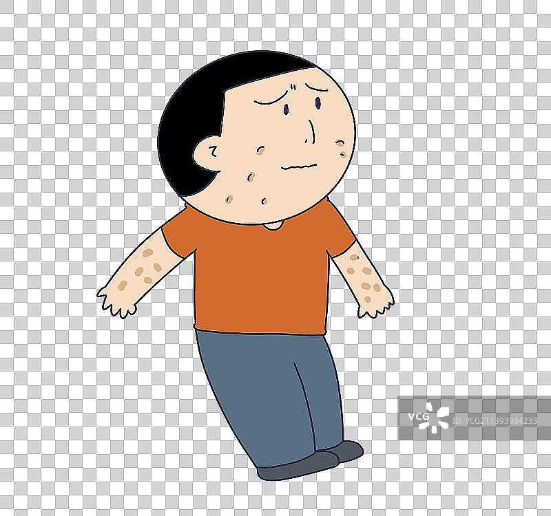 元素：皮肤病患者图片素材