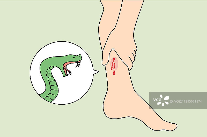 蛇咬人腿图片素材
