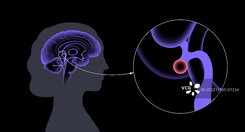 松果体解剖结构图片素材