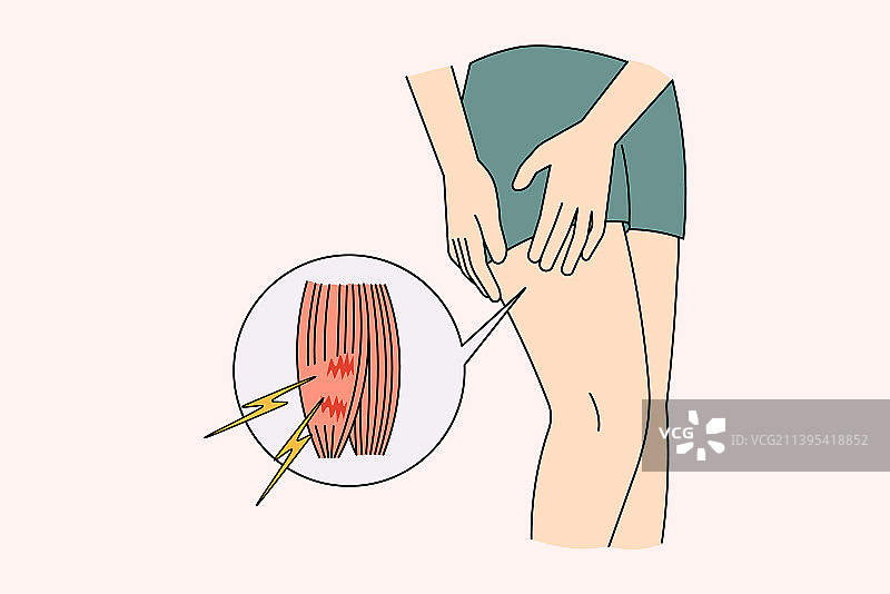 运动员拉伤腿部肌肉，感到疼痛图片素材