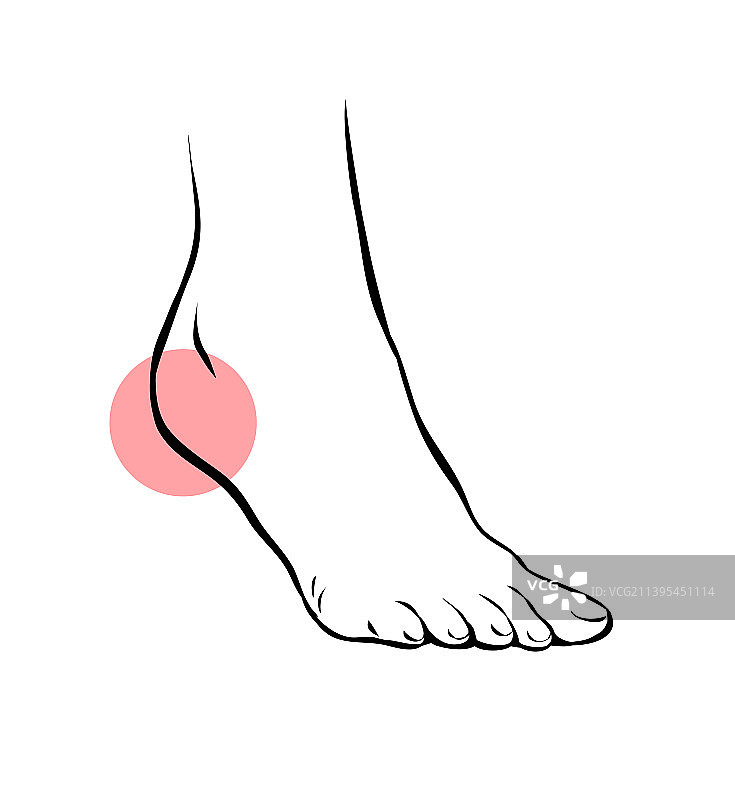 线条素描女性腿部疼痛图片素材