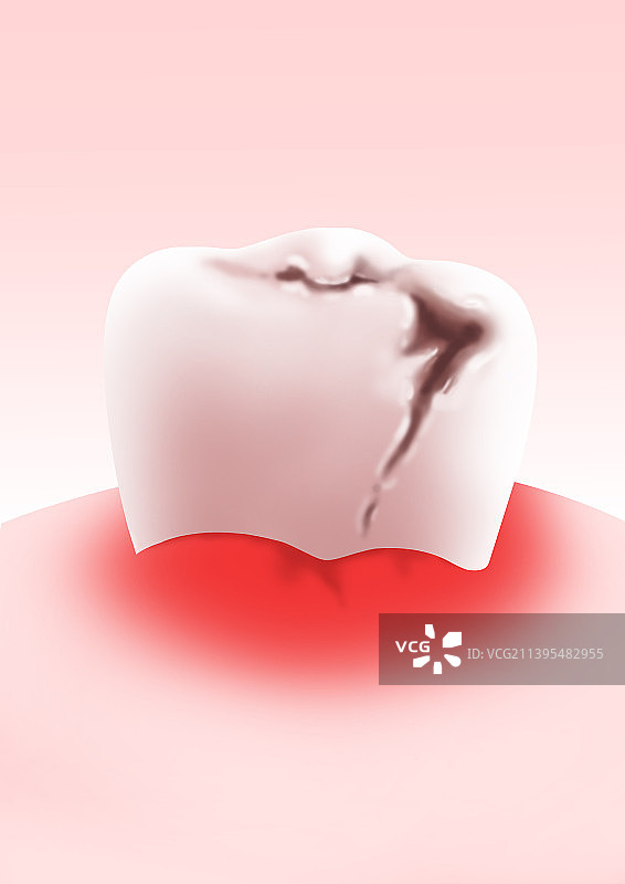 全国爱牙日牙疼牙龈炎发炎疼痛牙齿龃齿插画图片素材