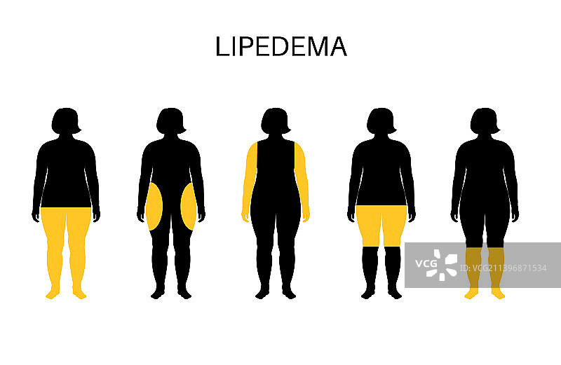 超重问题概念图片素材