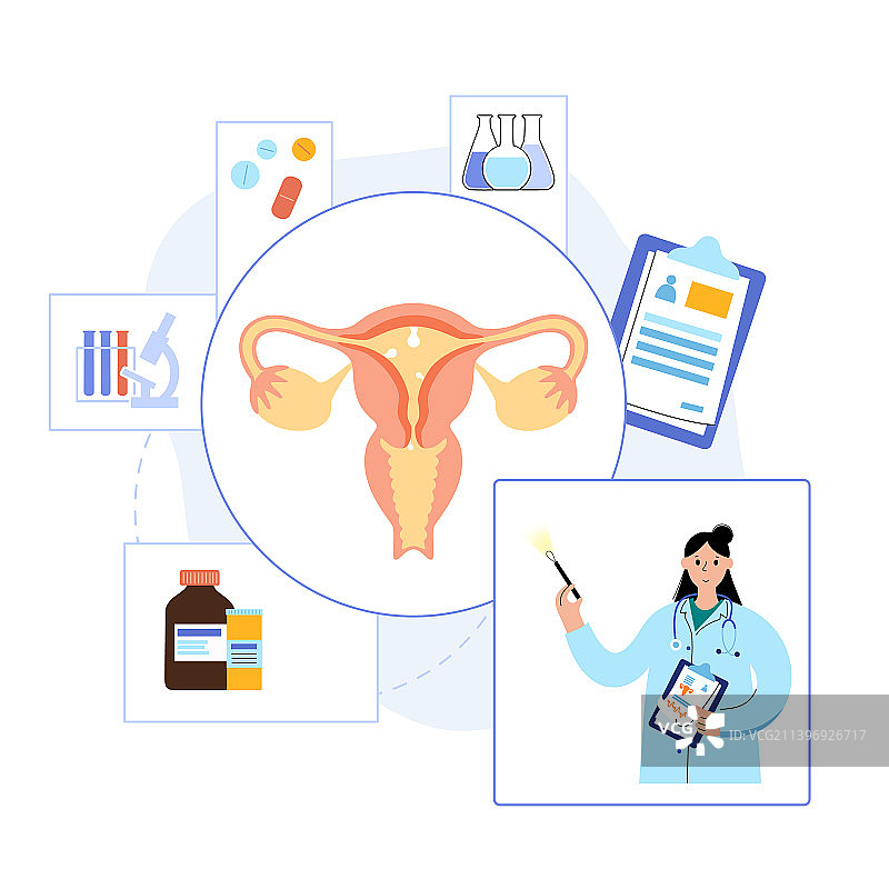 子宫息肉疾病图片素材