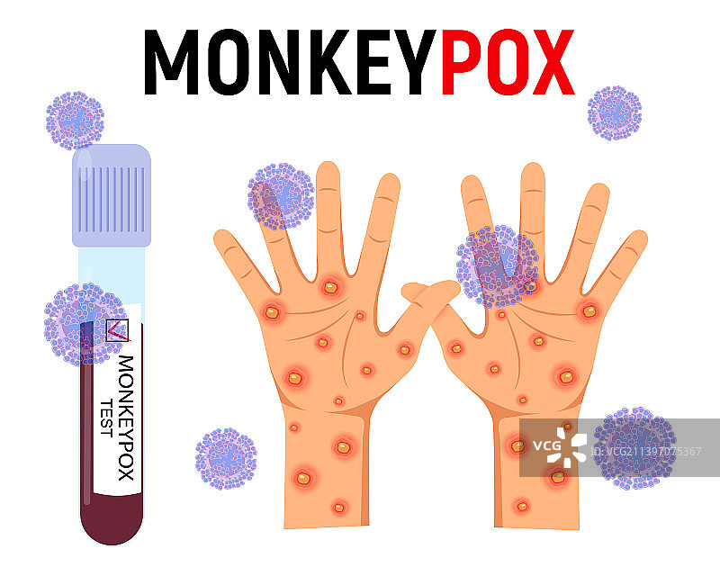 带有血液的试管和带有皮疹的人手图片素材