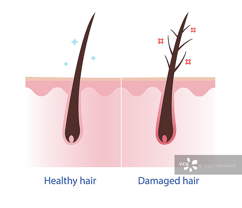健康的头发和受损的头皮图片素材