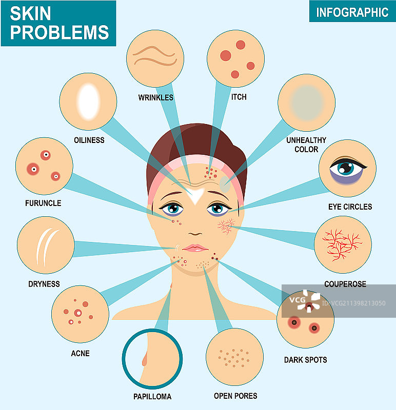 女性皮肤问题信息图图片素材