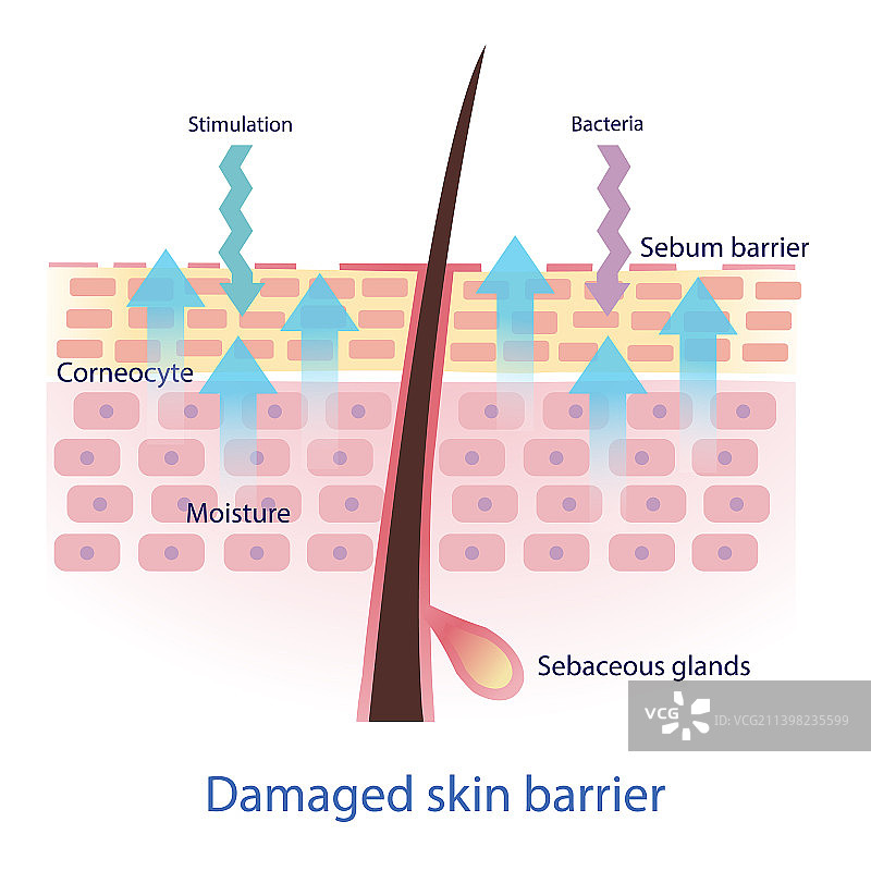 白色背景上受损的皮肤屏障图片素材