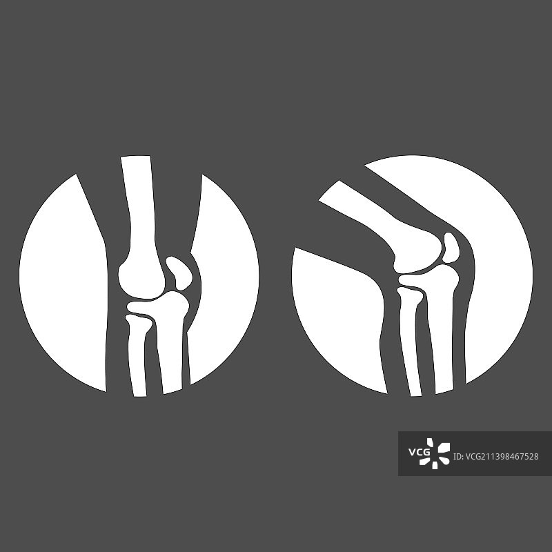 人体膝关节侧视图图片素材