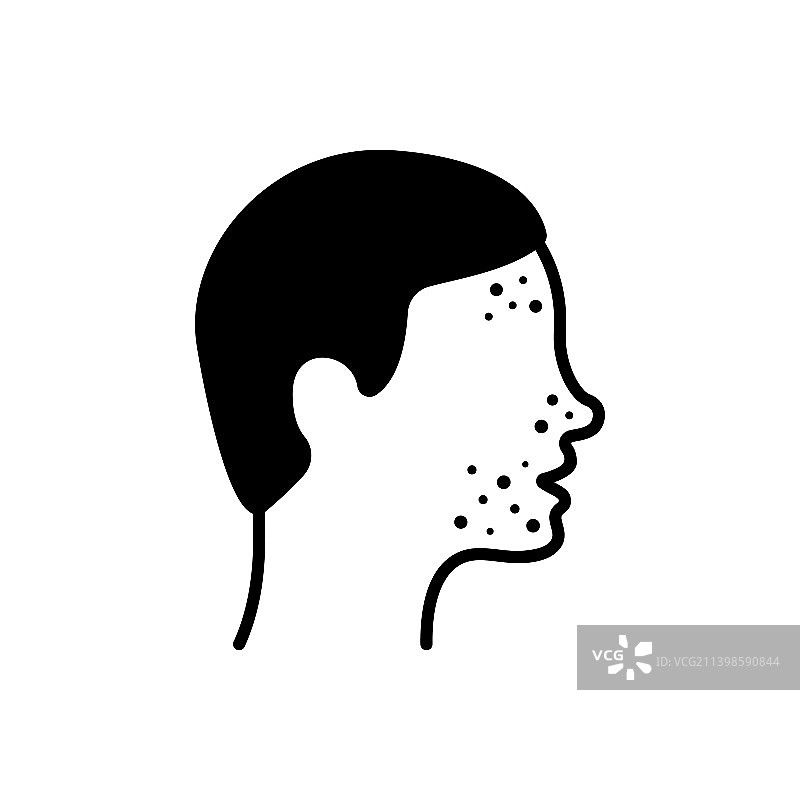 脸上长粉刺的男孩轮廓图标图片素材