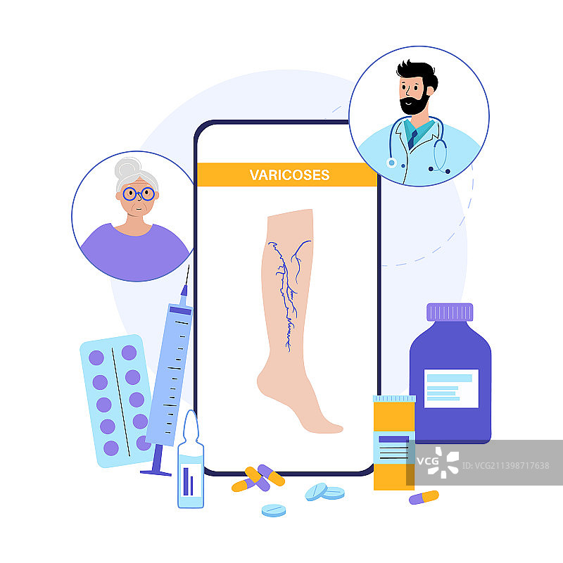 静脉曲张治疗图片素材