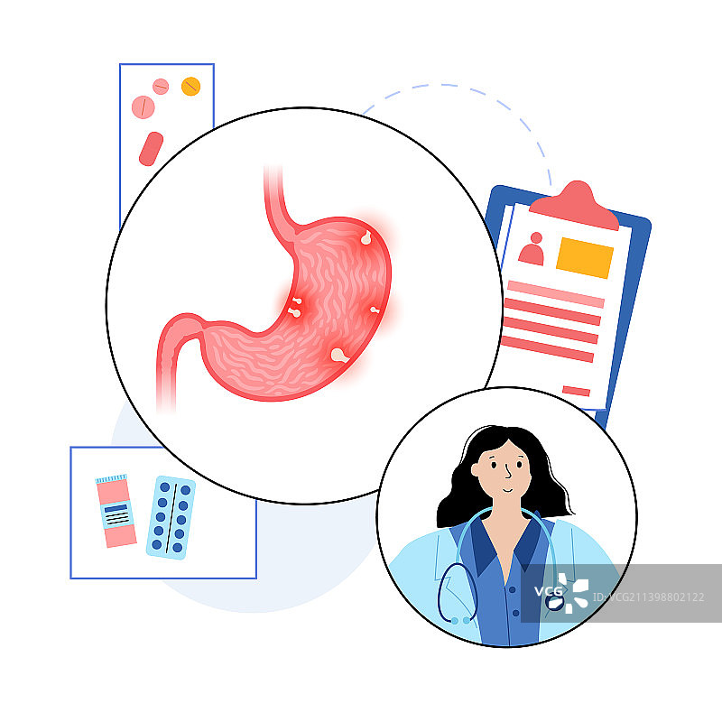 胃息肉疾病图片素材