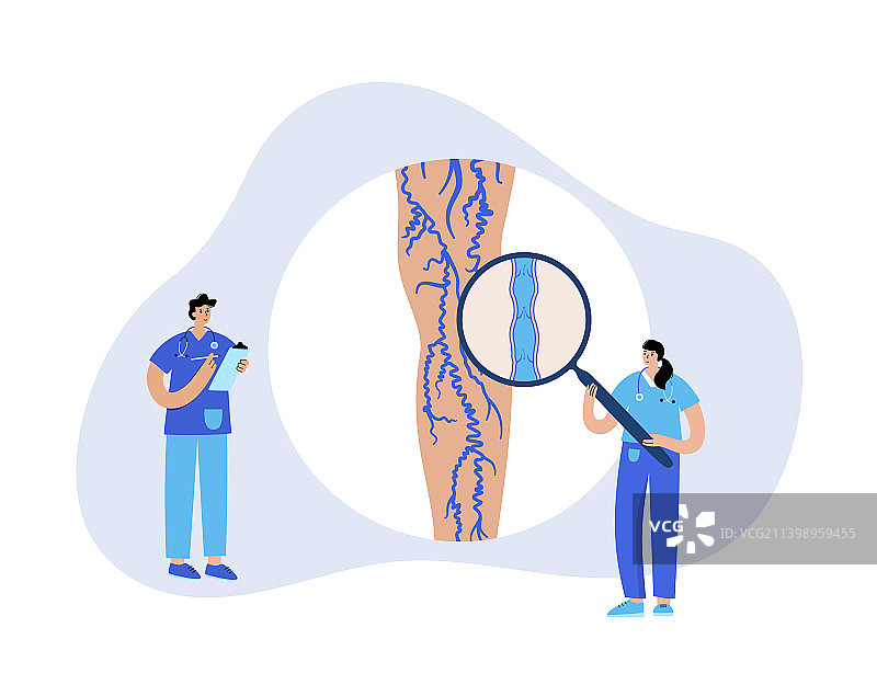 静脉曲张治疗图片素材