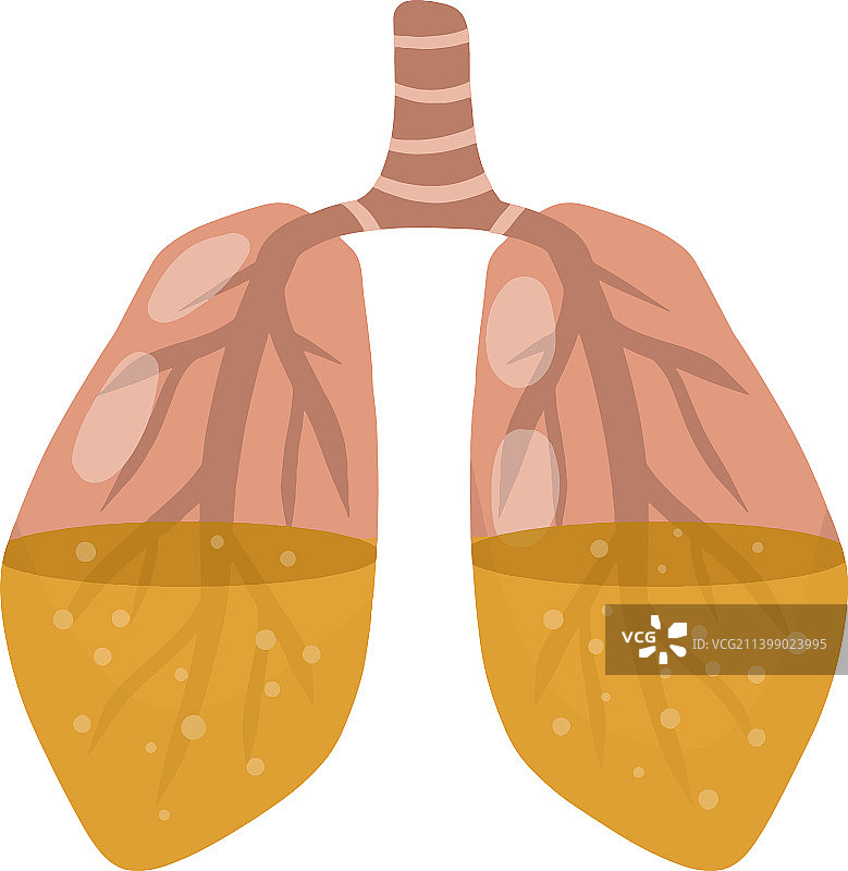 内呼吸器官疾病图片素材