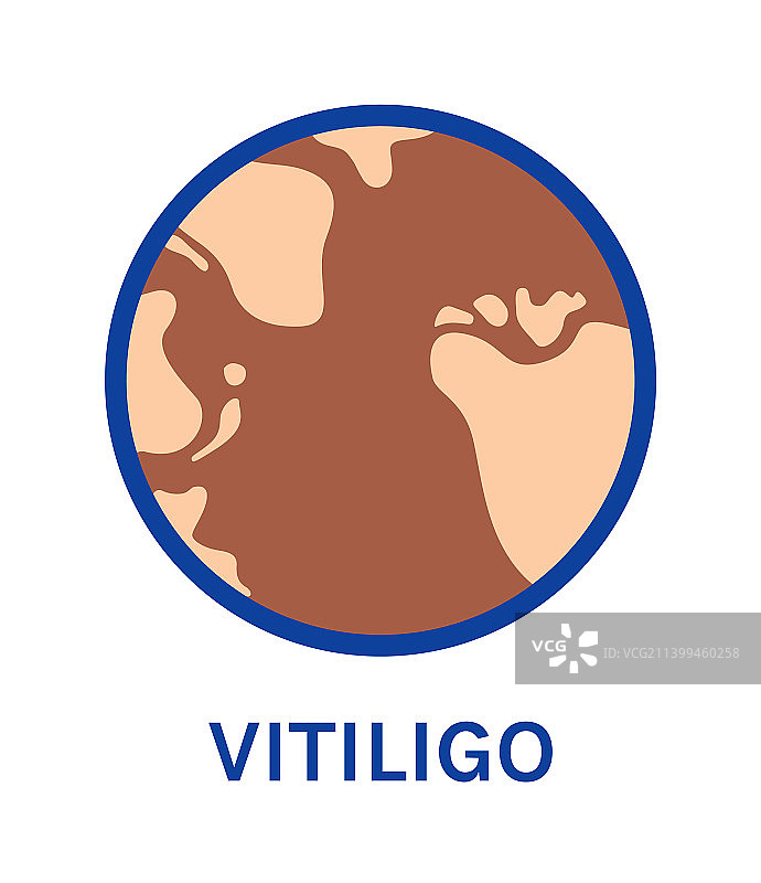 白癜风皮肤病色素沉着图标图片素材