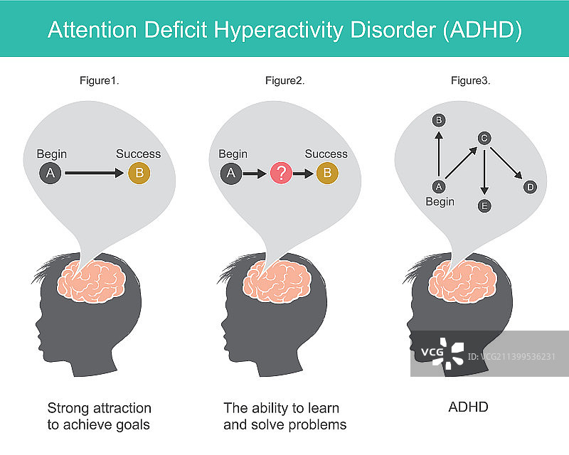 注意缺陷多动障碍解释图片素材