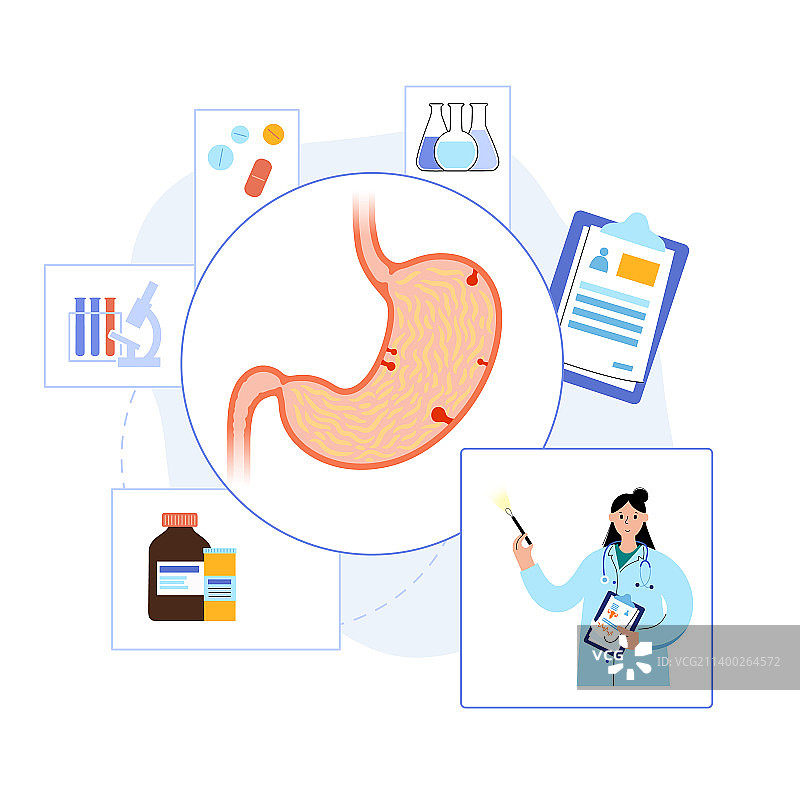胃息肉切除图片素材